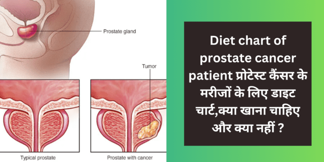 Diet chart of prostate cancer patient