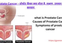 what is Prostate Cancer,treatment,types